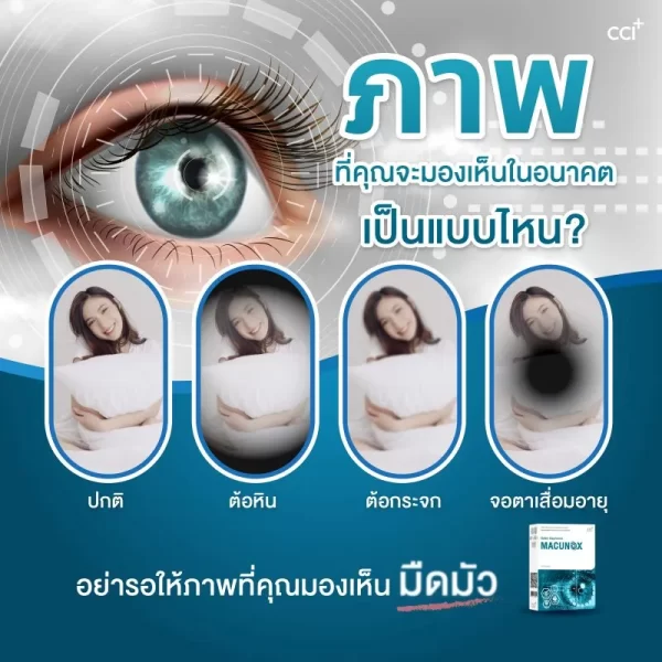 มาคูน็อกซ์ - Image 5