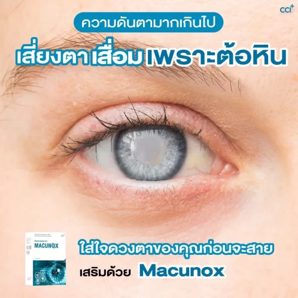 มาคูน็อกซ์ - Image 11