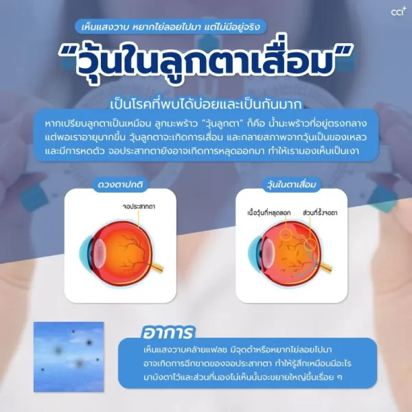 มาคูน็อกซ์ - Image 13