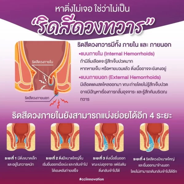ริดจิ - Image 4