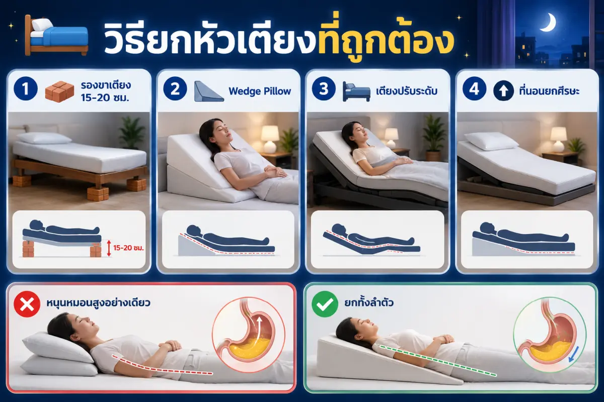 วิธียกหัวเตียงลดกรดไหลย้อน