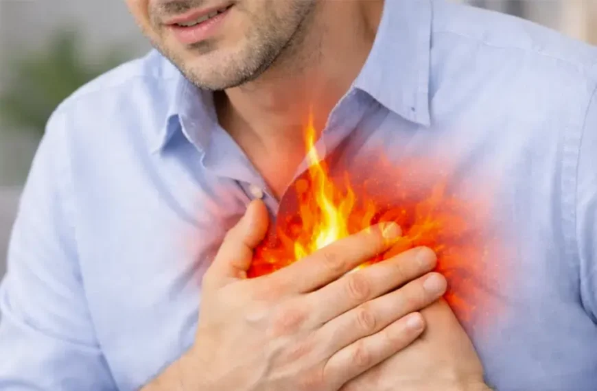 อาการกรดไหลย้อน แสบร้อนกลางอก heartburn จากกรดไหลย้อน