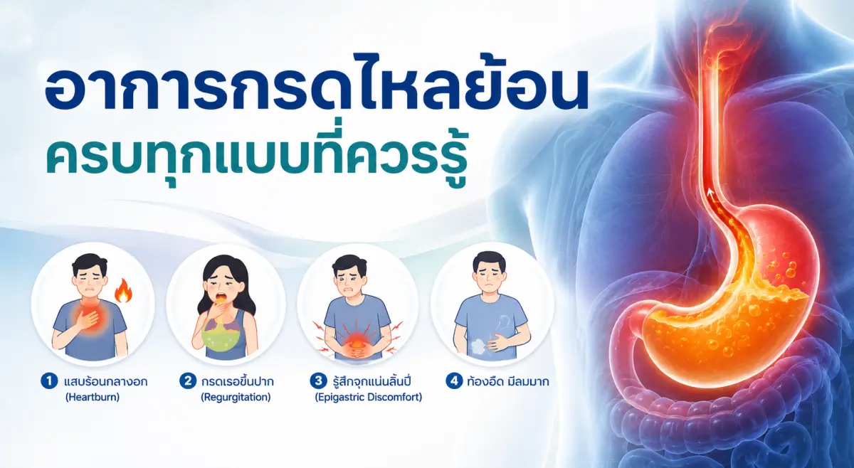 อาการของกรดไหลย้อน