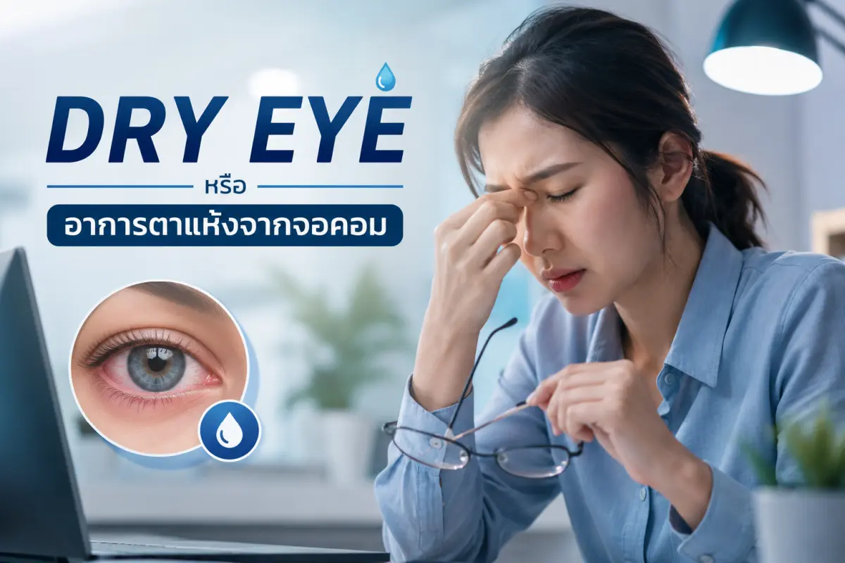 Dry Eye หรืออาการตาแห้งจากจอคอม อาการตาล้า แสบตา เคืองตา และแนวทางดูแลดวงตาสำหรับผู้ใช้หน้าจอเป็นเวลานาน