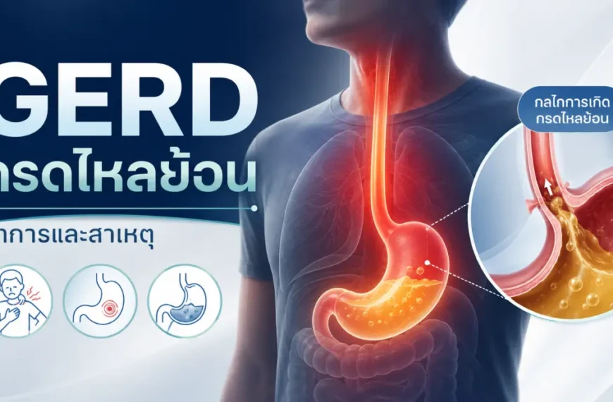 GERD กรดไหลย้อน อาการ สาเหตุ และกลไกการเกิดกรดไหลย้อนในหลอดอาหารและกระเพาะอาหาร