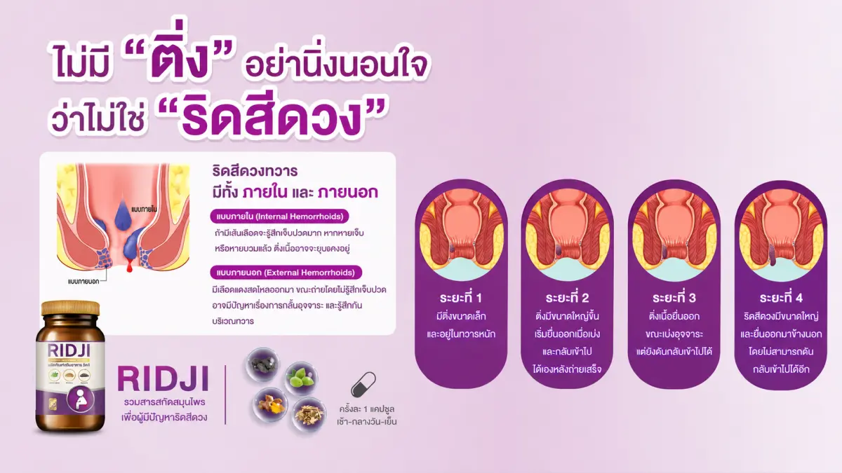 ระยะริดสีดวง