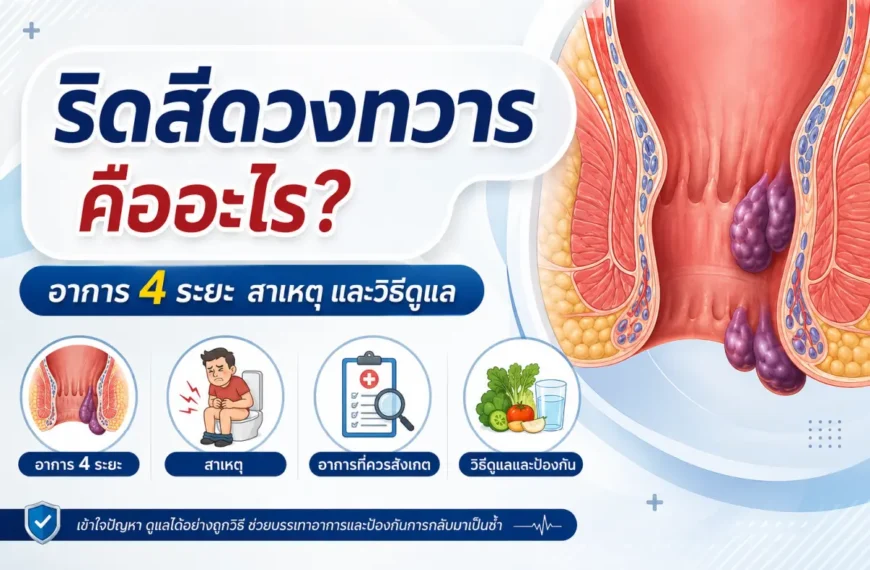 ริดสีดวงทวาร คืออะไร อาการ 4 ระยะ สาเหตุ ปัจจัยเสี่ยง และวิธีดูแลสุขภาพทางเดินอาหารส่วนล่าง