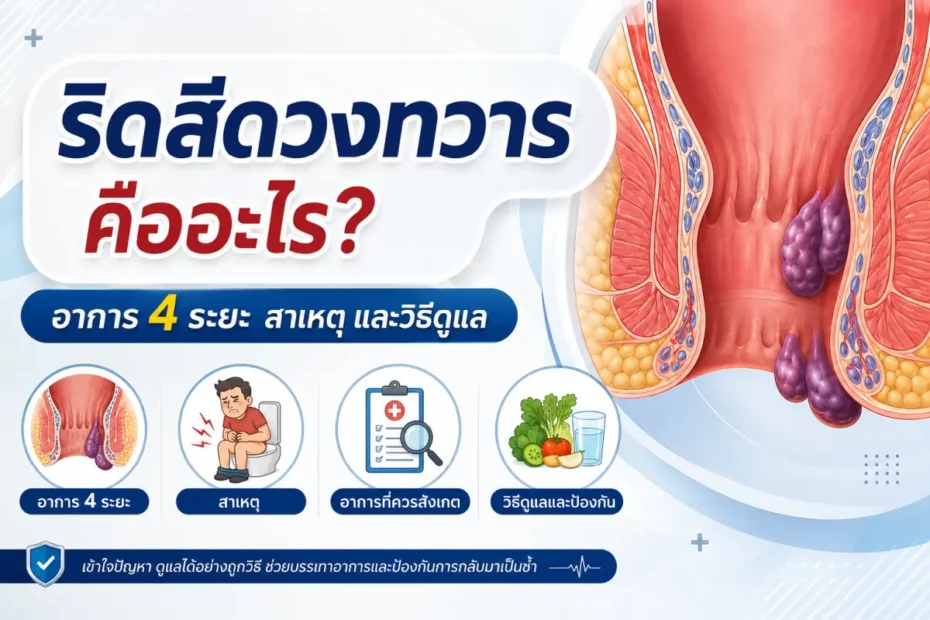 ริดสีดวงทวาร คืออะไร อาการ 4 ระยะ สาเหตุ ปัจจัยเสี่ยง และวิธีดูแลสุขภาพทางเดินอาหารส่วนล่าง