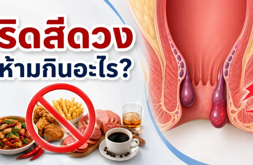 ผู้ป่วยริดสีดวงทวารกับอาหารที่ควรหลีกเลี่ยง เช่น อาหารเผ็ด ของทอด เนื้อแปรรูป แอลกอฮอล์ และกาแฟ เพื่อช่วยลดการระคายเคืองและอาการกำเริบของริดสีดวงทวาร