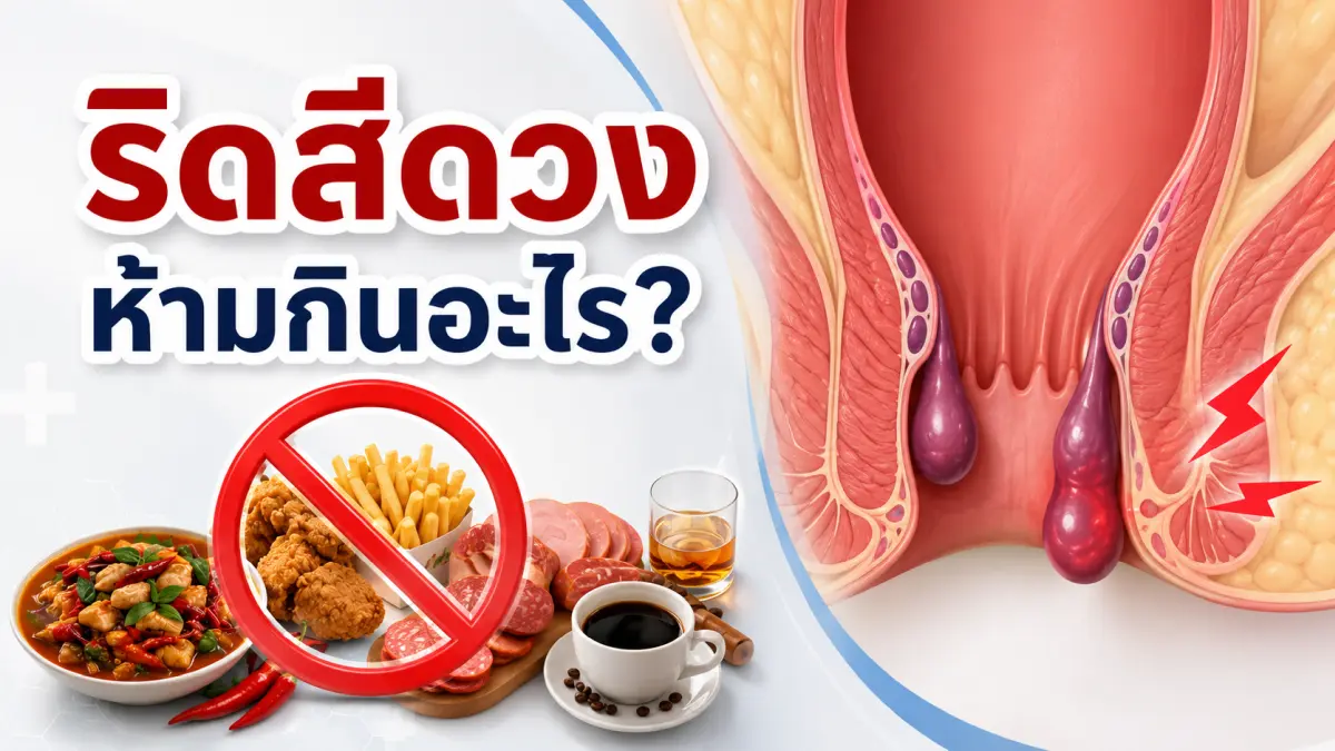 ผู้ป่วยริดสีดวงทวารกับอาหารที่ควรหลีกเลี่ยง เช่น อาหารเผ็ด ของทอด เนื้อแปรรูป แอลกอฮอล์ และกาแฟ เพื่อช่วยลดการระคายเคืองและอาการกำเริบของริดสีดวงทวาร